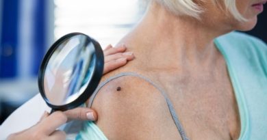 Estudo da USP abre novas perspectivas para o tratamento do tipo mais letal de câncer de pele