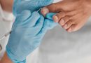 Atuação de podólogos garante a saúde dos pés