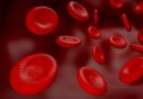 Sistema imune de pacientes com anemia falciforme melhora após transplante de células-tronco da medula
