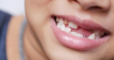 Anti-inflamatórios de uso comum na infância podem causar alterações no esmalte dentário, revela estudo